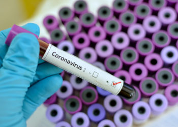 Vuelve a aumentar la cifra de muertos en España por coronavirus: 769 en las últimas 24 horas 1 2024