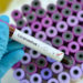 Coronavirus: asciende a cuatro el número de sospechosos en Misiones 5 2024