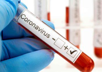 Investigadores israelíes anunciaron un tratamiento efectivo contra el coronavirus como prevención o en los primeros tramos de la enfermedad 7 2024
