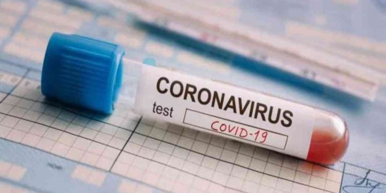 América Latina, epicentro de la pandemia, afronta un “mes crítico” para intentar frenar al coronavirus 1 2023