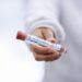Coronavirus: China anuncia para diciembre la otra vacuna que se probaría en la Argentina 3 2024