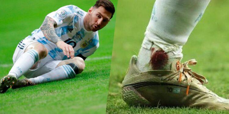 El tobillo herido de Lionel Messi y la comparación con Diego Armando Maradona 1 2024