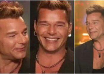 Por esta razón Ricky Martin apareció con el rostro desfigurado en una entrevista 1 2023
