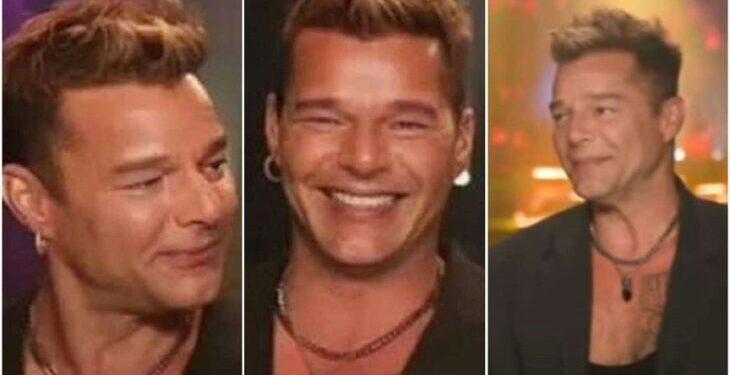 Por esta razón Ricky Martin apareció con el rostro desfigurado en una entrevista 1 2024