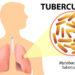 En 2022, Misiones diagnosticó 224 casos de tuberculosis 3 2024